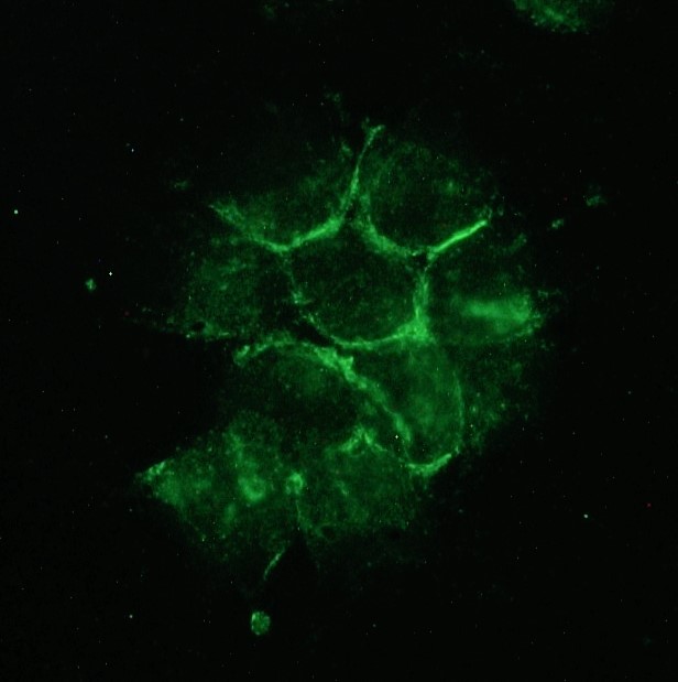 Figure 1. Indirect immunofluorescence staining of NCAM/CD56 at the attachement sites of the human small cell lung cancer cell line NCI-H82 using MUB2033P, clone 123A8 at a dilution of 1:200.